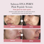 Cargar imagen en el visor de la galería, Medicube - PDRN Pink One Day Serum Set
