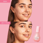 Cargar imagen en el visor de la galería, Glow Recipe - Watermelon Glow Niacinamide Dew Drops Serum *dañado*
