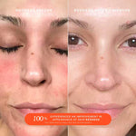 Cargar imagen en el visor de la galería, PRE-VENTA - Tower 28 Beauty SOS SOS Daily Rescue Facial Spray with Hypochlorous Acid
