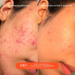 Cargar imagen en el visor de la galería, PRE-VENTA - Tower 28 Beauty SOS SOS Daily Rescue Facial Spray with Hypochlorous Acid
