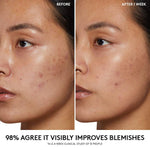 Cargar imagen en el visor de la galería, PRE-VENTA - Fenty Beauty Cherry Dub Pore Purify’r Gel Cleanser
