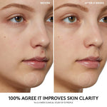 Cargar imagen en el visor de la galería, PRE-VENTA - Fenty Beauty Cherry Dub Pore Purify’r Gel Cleanser
